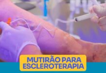 Secretaria de Saúde realizará mutirão de triagem para tratamento com escleroterapia nos dias 03 e 04 de Dezembro