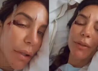 Ivete é hospitalizada após passar mal e desmaiar: ‘Caí no chão com tudo’