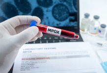 Ministério da Saúde confirma 81 casos de mpox no Brasil em 2026