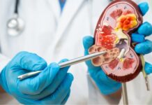 Doença renal avança no país e expõe gargalos de acesso à diagnóstico precoce e à diálise