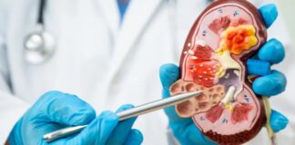 Doença renal avança no país e expõe gargalos de acesso à diagnóstico precoce e à diálise